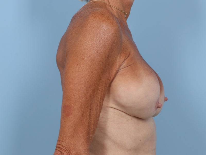 bna image