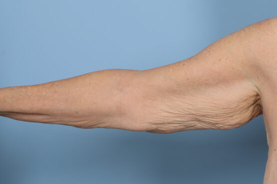 Case # 8 before photo