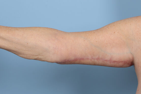 Case # 8 after photo