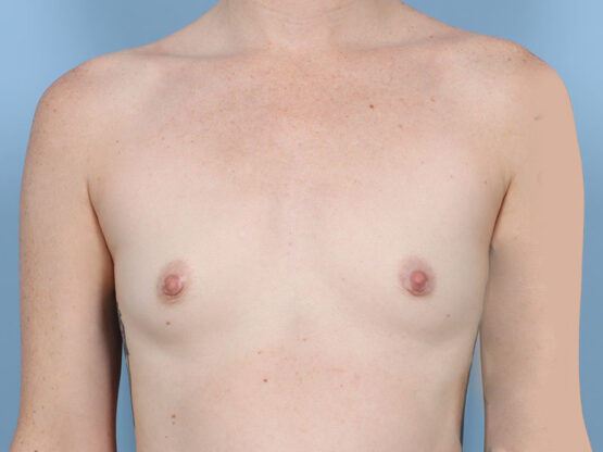 Case # 30 before photo