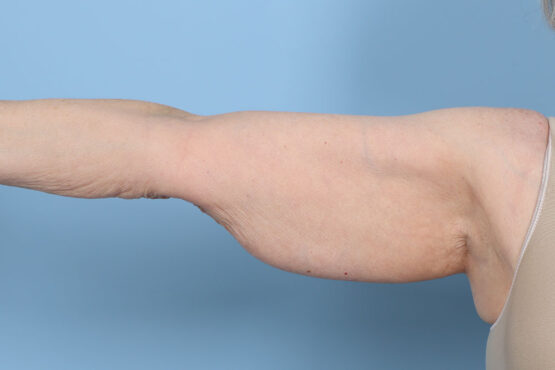 Case # 5 before photo