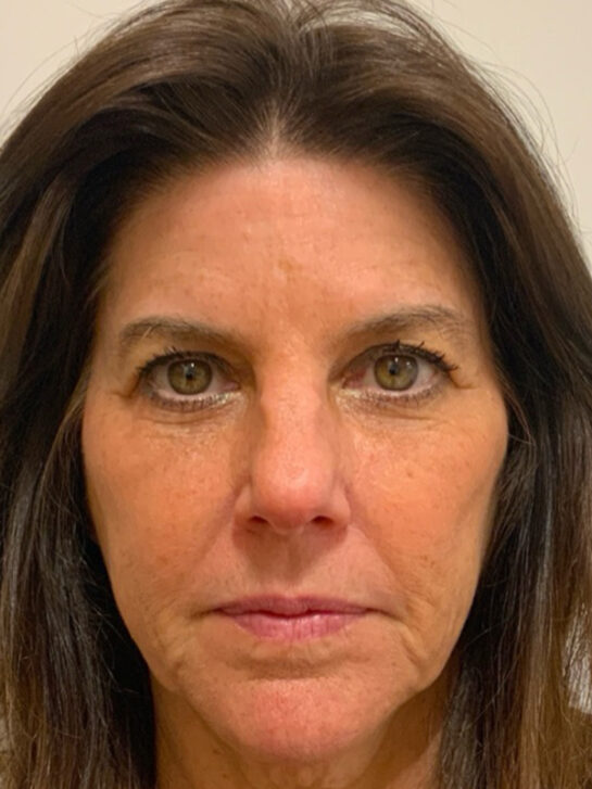 Case # 34 before photo