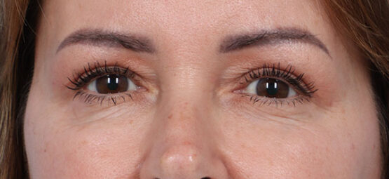 Case # 5 after photo