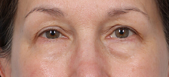 Case # 7 before photo