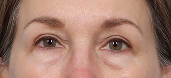 Case # 7 after photo