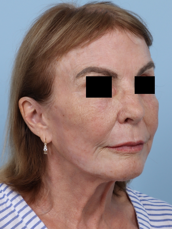 bna image