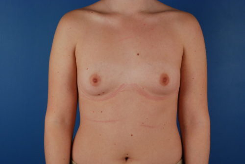 Case # 7 before photo