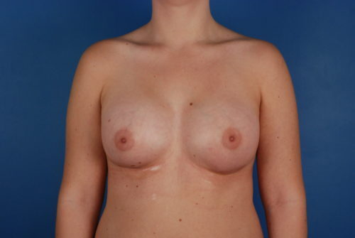 Case # 7 after photo