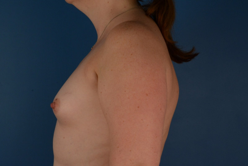  bna image