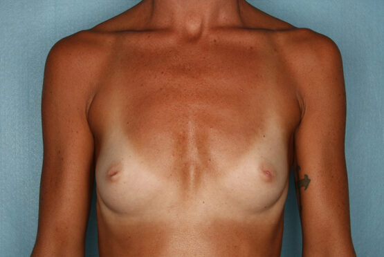 Case # 8 before photo