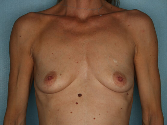 Case # 12 before photo