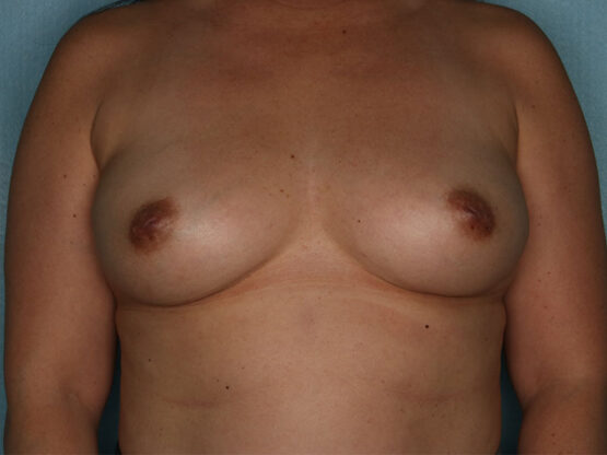 Case # 17 before photo