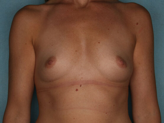 Case # 19 before photo