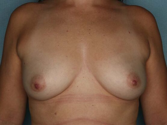 Case # 21 before photo