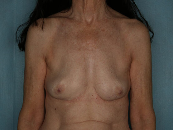 Case # 22 before photo