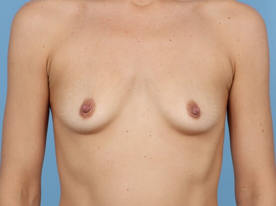 Case # 24 before photo