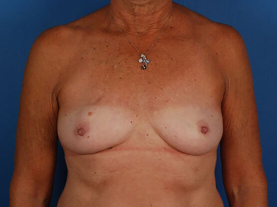 Case # 6 before photo