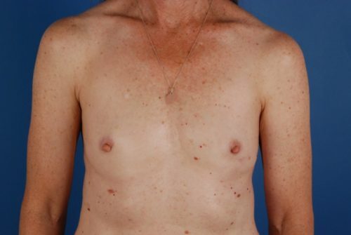 Case # 8 before photo