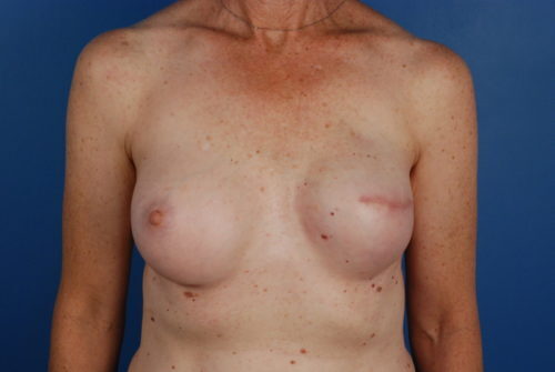 Case # 8 after photo