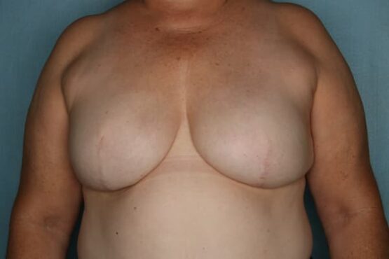 Case # 16 after photo