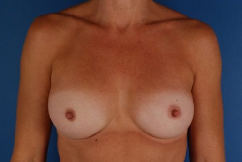 Case # 5 before photo