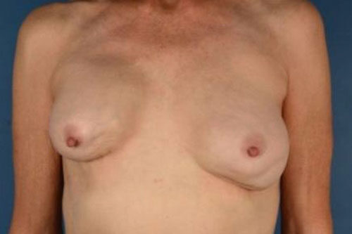 Case # 6 before photo