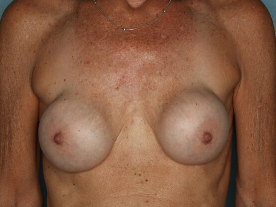 Case # 9 before photo