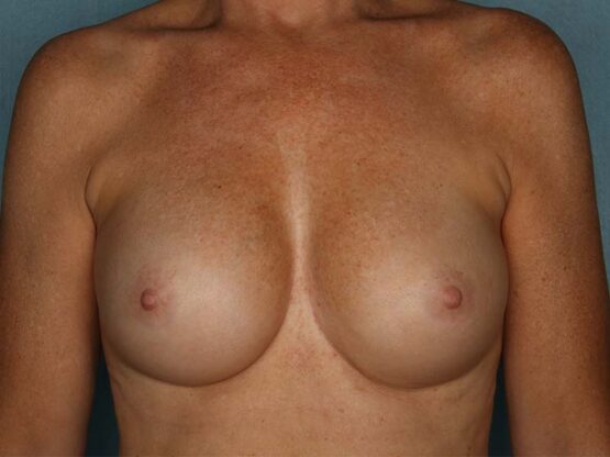 Case # 12 before photo