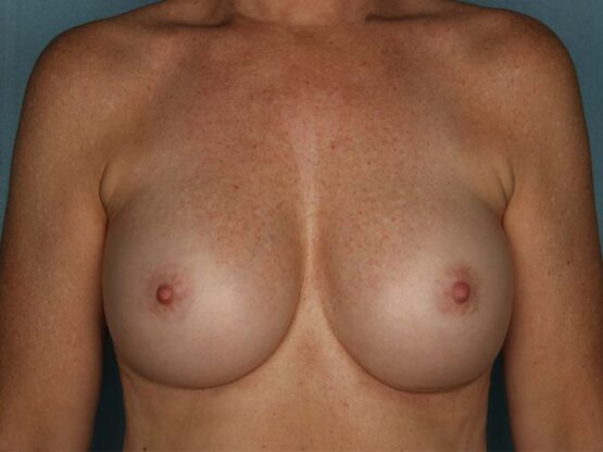 Case # 12 after photo