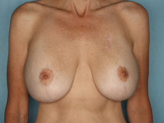 Case # 13 before photo