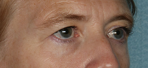 bna image