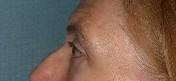 bna image