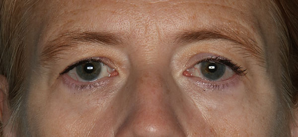  bna image