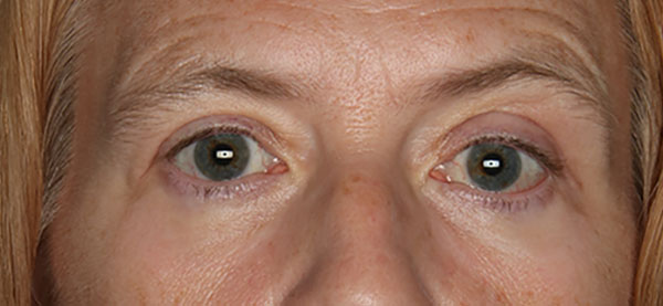 bna image