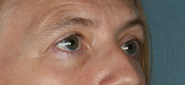 bna image