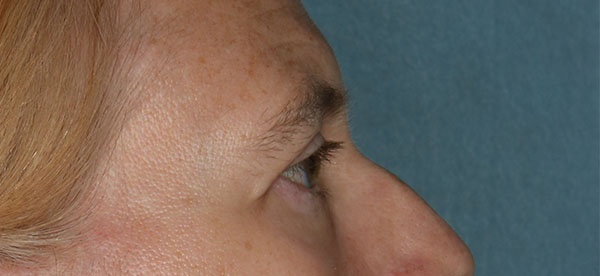 bna image