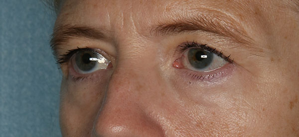  bna image