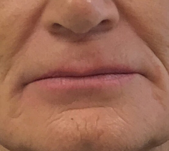 Case # 1 before photo