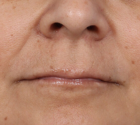 Case # 2 before photo