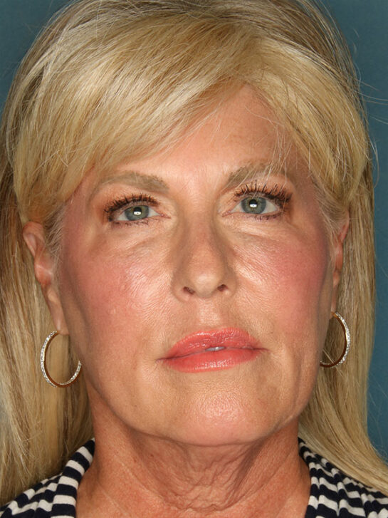 Case # 2 before photo