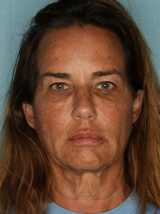 Case # 3 before photo