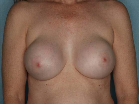 Case # 18 before photo