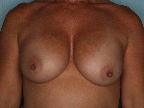 Case # 19 before photo