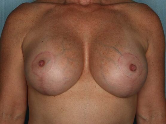 Case # 19 after photo