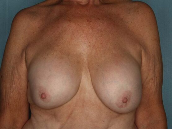 Case # 20 before photo