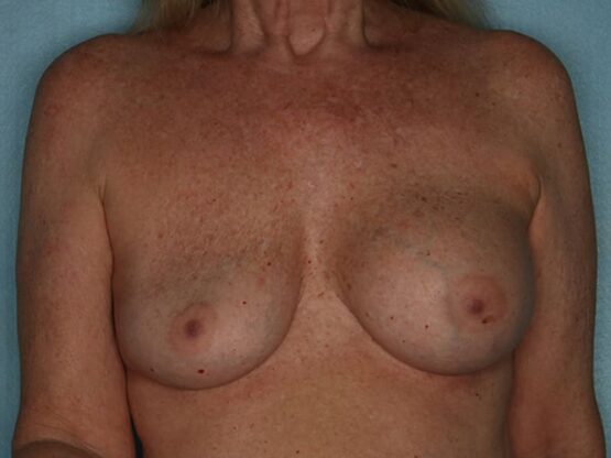 Case # 21 before photo