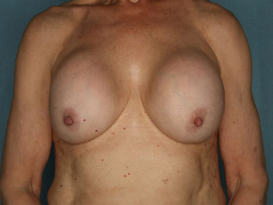 Case # 22 before photo