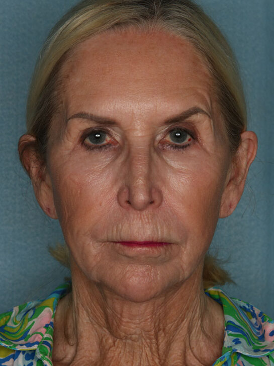 Case # 24 before photo