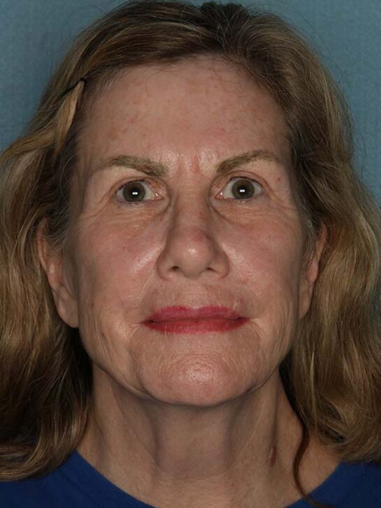 Case # 26 before photo