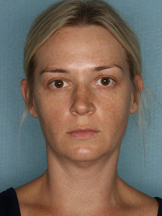 Case # 1 before photo